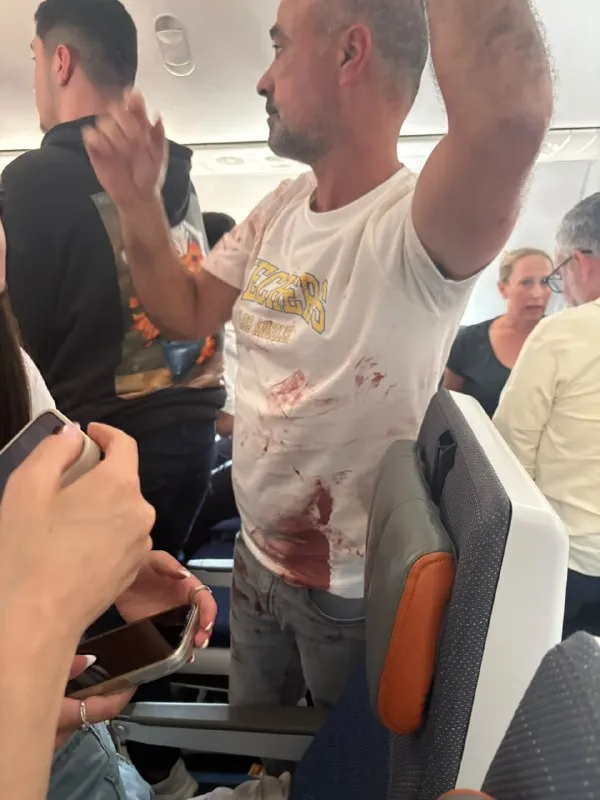Flight or Fight : फ्लाइट के पायलट आपस में भिड़े, कॉकपिट में चले चाकू, दो घायल, 180 यात्री थे सवार, चीख-पुकार वाला वीडियो फोटो वायरल